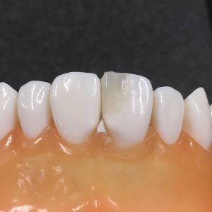 20161120-079