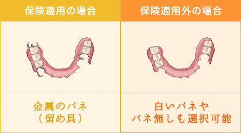 部分入れ歯