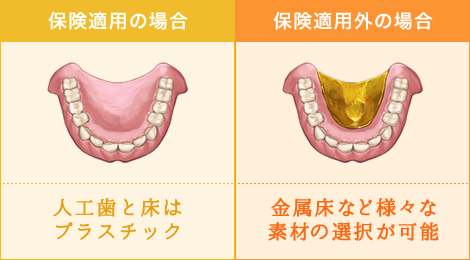 総入れ歯